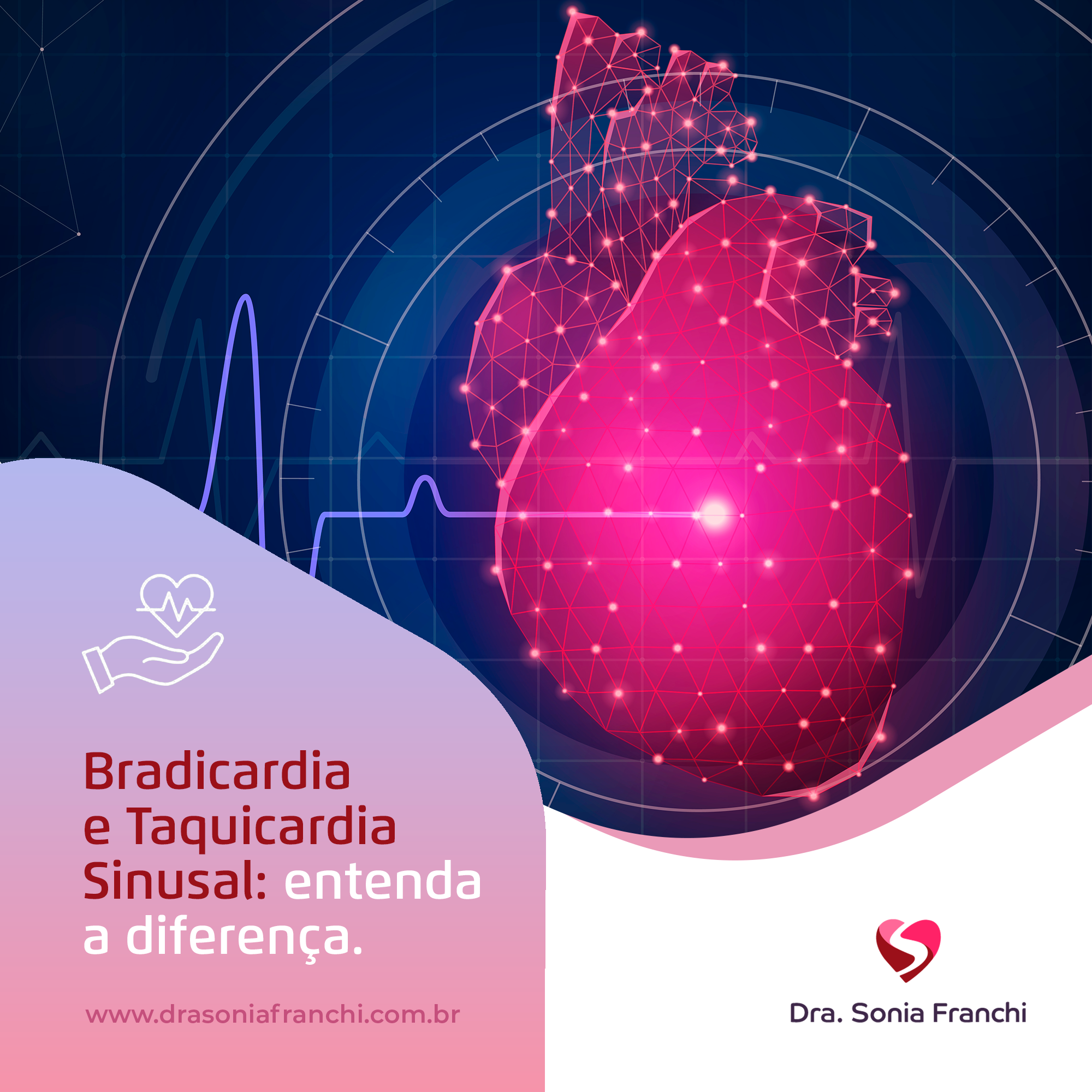 Bradicardia E Taquicardia Sinusal Entenda A Diferen A Dra Sonia Franchi Cardiologista Infantil